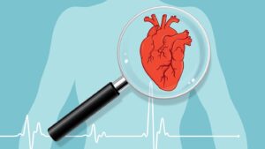 نارسایی قلبی چه عوارضی دارد و ناشی از چیست؟