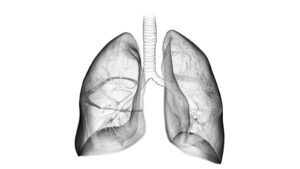 عوارض سندرم زجر تنفسی حاد (ARDS) چیست؟