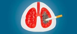 سیگار چه اثری بر ریه دارد و چگونه منجر به سرطان ریه می شود؟
