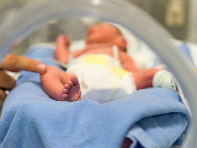 زردی در نوزادان چقدر شایع است؟