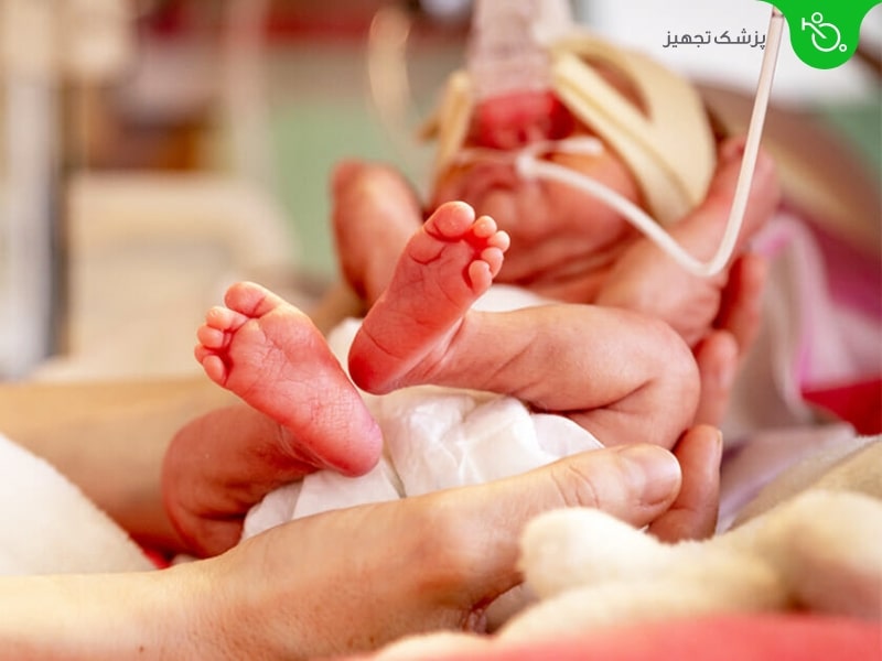 چه چیزی باعث ایجاد سندرم دیسترس تنفسی نوزاد می شود؟