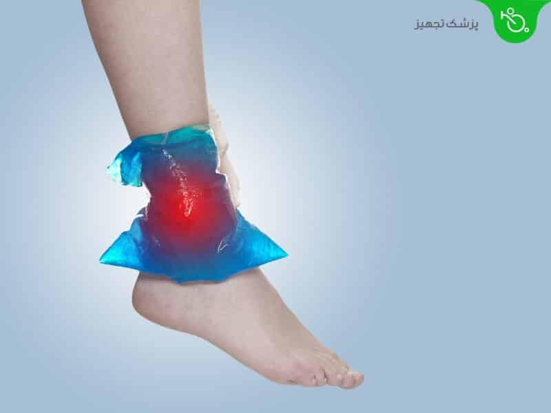 درمان های خانگی تورم پا، مچ پا یا ساق پا
