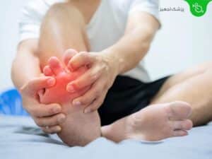 علت ورم پا؛ مچ پا و ساق پا چیست و چگونه درمان می شود؟