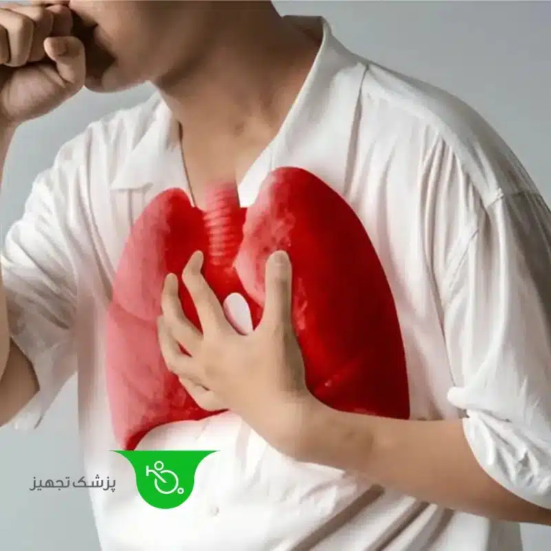 بیماری سارکوئیدوز ریوی