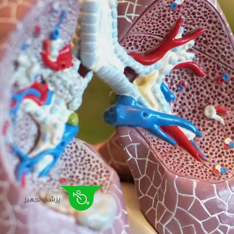 بیماریهای ریوی